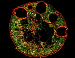 Giourdas Xeirourgiki Βασίλειος Γκιούρδας Βαρϊατρική παχυσαρχία γαστρικό μανίκι γαστρικό μπότοξ botox διαφραγματοκήλη παλινδρόμιση πτύχωση αιμορροΐδες μεταβολικό