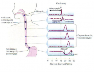 Giourdas Xeirourgiki Βασίλειος Γκιούρδας Βαρϊατρική παχυσαρχία γαστρικό μανίκι γαστρικό μπότοξ botox διαφραγματοκήλη παλινδρόμιση πτύχωση αιμορροΐδες μεταβολικό