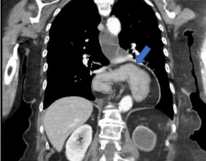 Giourdas Xeirourgiki Βασίλειος Γκιούρδας Βαρϊατρική παχυσαρχία γαστρικό μανίκι γαστρικό μπότοξ botox διαφραγματοκήλη παλινδρόμιση πτύχωση αιμορροΐδες μεταβολικό