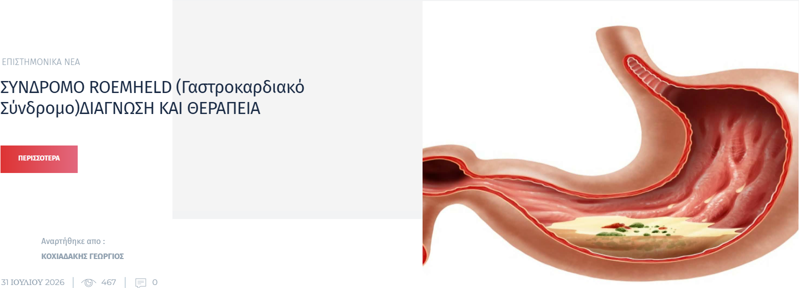 Η δημοσίευση για το σύνδρομο Roemheld στο Cardiology News